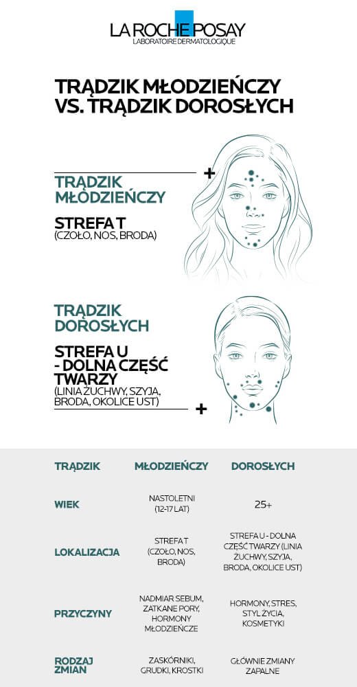 Trądzikowa mapa twarzy: trądzik młodzieńczy na czole, nosie i brodzie, a także trądzik dorosłych na żuchwie, szyi, brodzie i okolicach ust