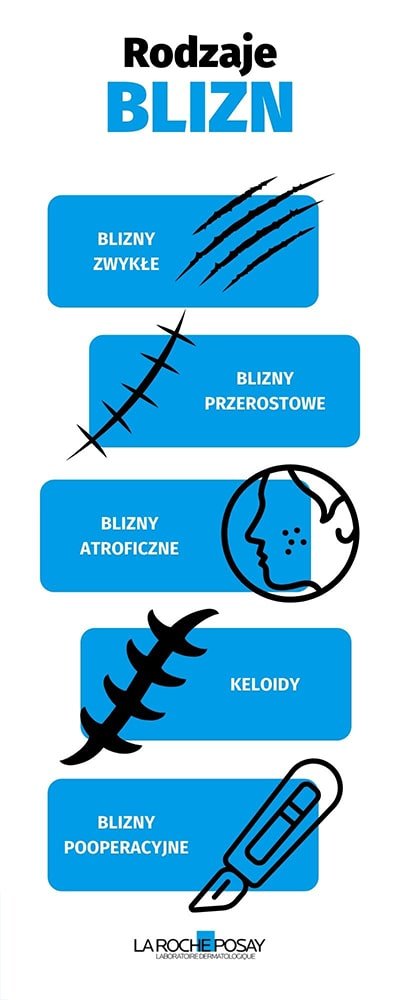 Rodzaje blizn na twarzy i ciele