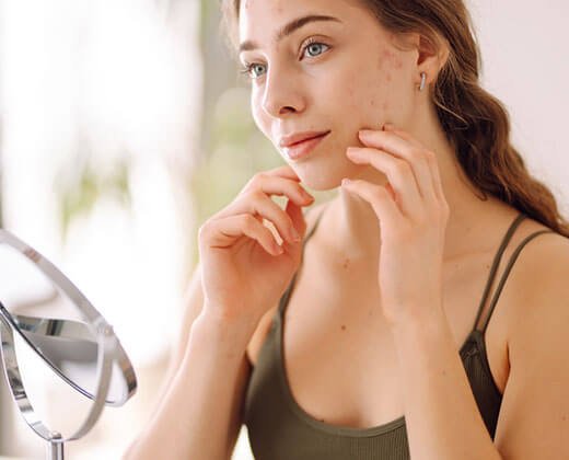Kobieta o cerze skłonnej do trądziku