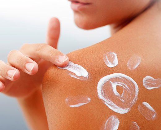 Kobieta smarująca kremem z filtrem UV skórę na plecach, aby uniknąć oparzeń słonecznych