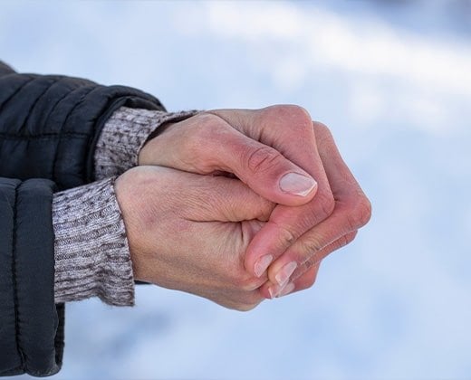 Pękająca skóra na dłoniach wywołana działaniem mrozu