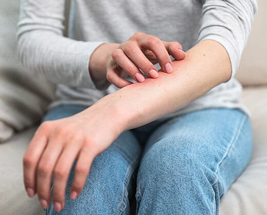 Stan zapalny na skórze rąk