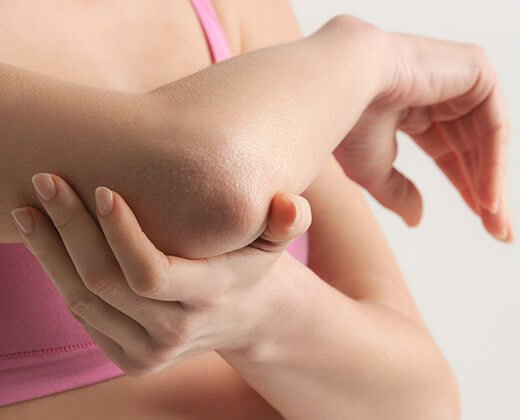 Kobieta z suchymi łokciami