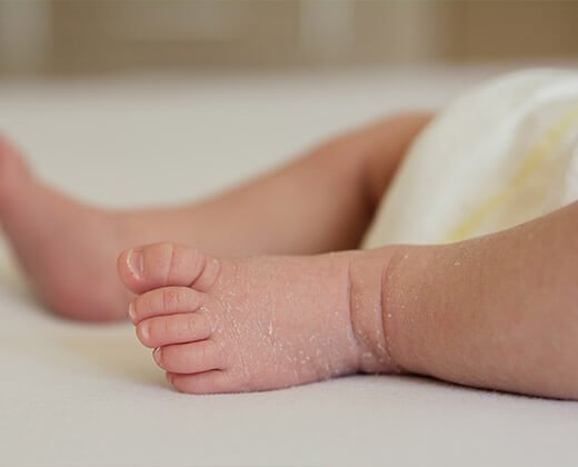 Suche nogi u niemowlaka