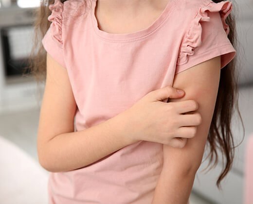 swędząca i sucha skóra na rękach u dziecka