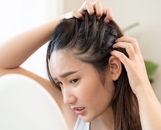 Dokuczliwe swędzenie skóry głowy